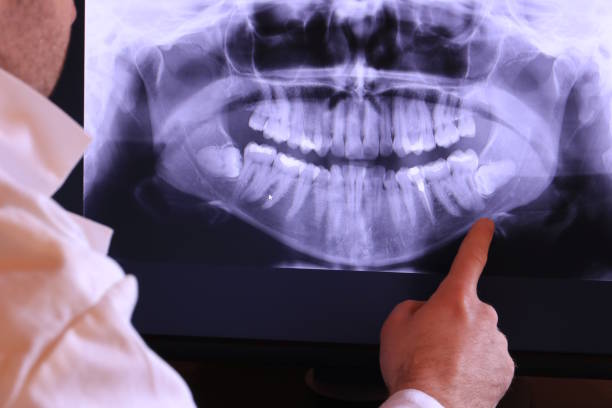 Best Emergency Treatment for Toothache in Bradley, WV